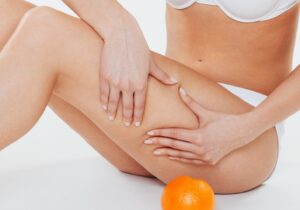 Los 3 suplementos naturales para eliminar la celulitis