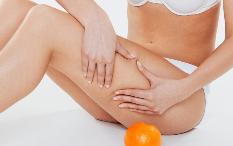 Los 3 suplementos naturales para eliminar la celulitis Los 3 suplementos naturales para eliminar la celulitis