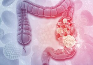 Remedio natural para una buena limpieza de colon