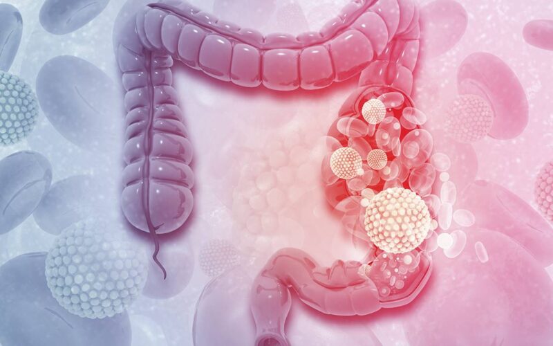 Remedio natural para una buena limpieza de colon